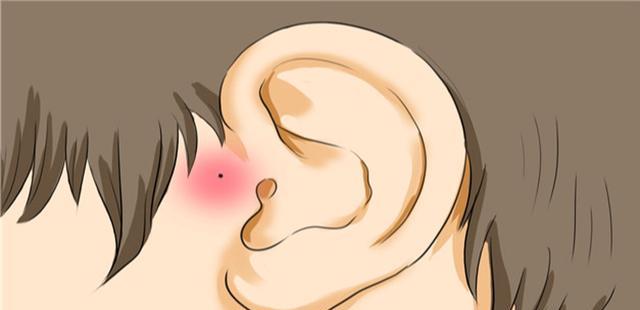 恋恋健身|耳朵时不时发痒，却啥也掏不出，这是为什么呢？