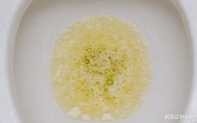 尿酸|肾衰来临之前，上厕所会有3个异常，若是一个不占，那就偷笑吧
