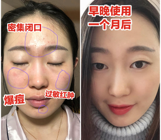 时尚青草 销品商城 |“人类高质量女生”秋季必备护肤单品！