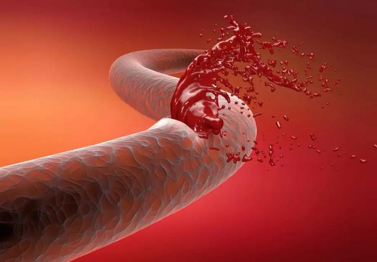 蔬菜|蔬菜遇上这1物，堪称天然“溶栓剂”，每天吃一口，血管“嫩”如婴儿