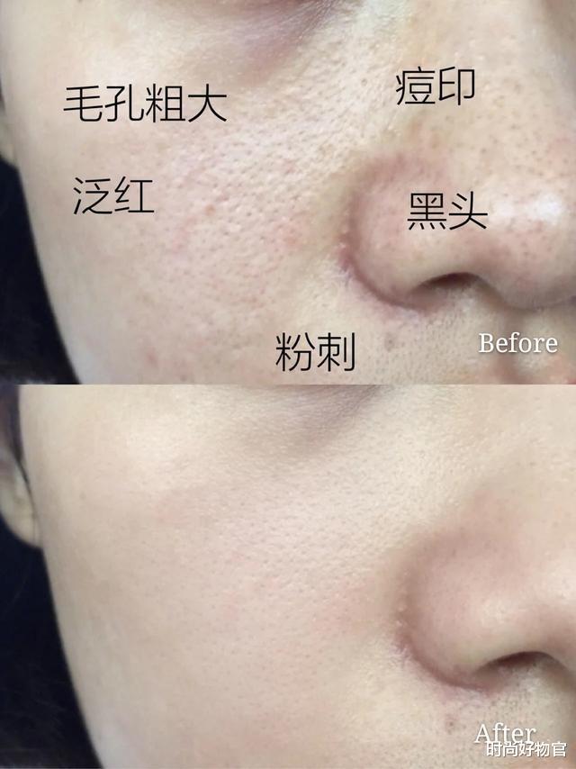 时尚好物官|“不老女神”林志玲献爱心，素颜和孩子玩耍，皮肤光滑似“少女”