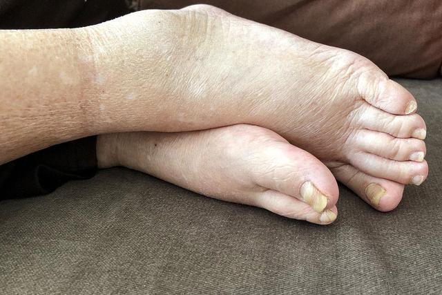 饮食|35岁到45岁是女人“长胖期”？晨起有这4个好习惯说明你不容易胖