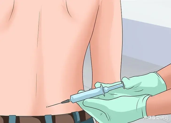 近视|骶髂关节疼痛的原因及缓解技巧