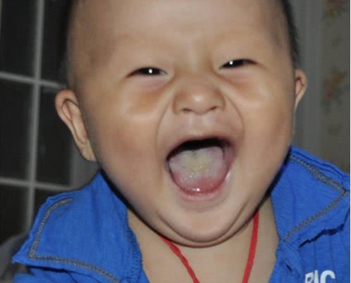 肝脏|这3种食物，吃一口等于1包辣条！医生坦言：从不让自家孩子吃