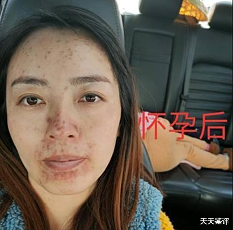 女子整容成功嫁给富二代,孕期突然“现原形”,怕老公嫌弃而大哭