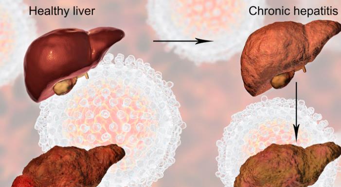 医生|再次提醒:别拿5种小病不当回事,预防发展成癌症的可能性