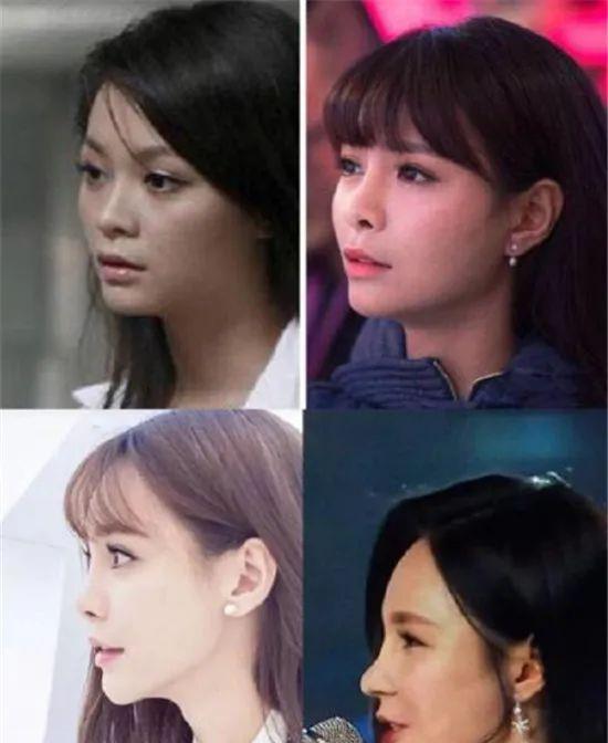 古力娜扎|15位女星的鼻子：王菲肉鼻头，娜扎尖鼻子，吴昕鹰钩鼻