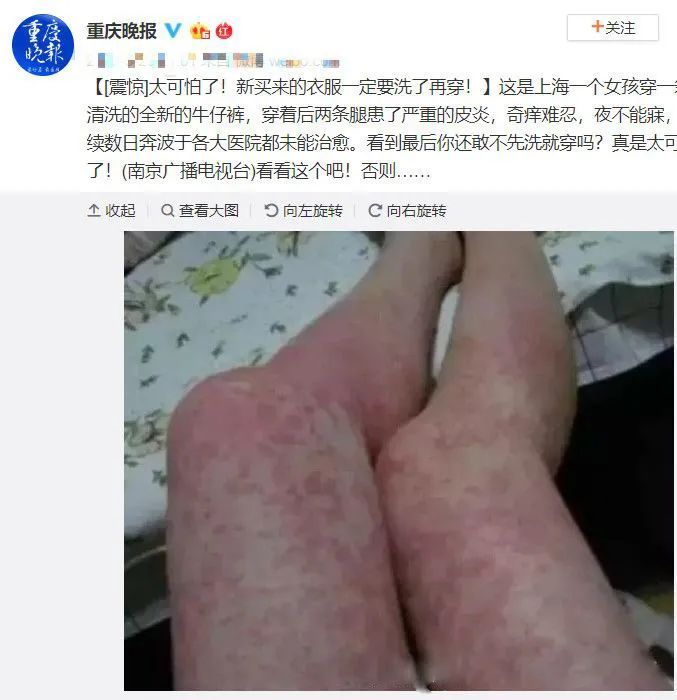 |新买的衣服上不能直接穿，因为含有甲醛——宜维欧室内净化