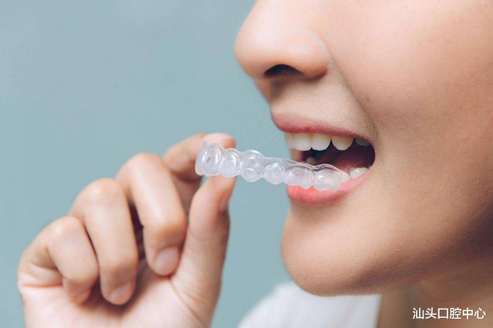 汕头口腔中心 戴隐形牙套时不适合吃什么东西？远离这几样，让你避免尴尬！
