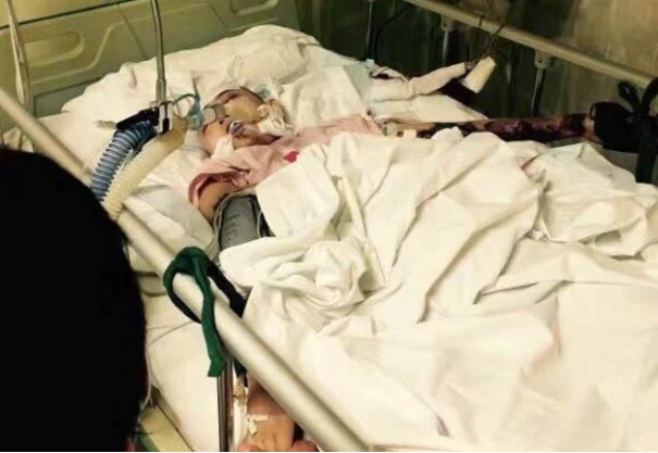 徐婷|2016年，徐婷全身溃烂死在医院，全家的提款机没了