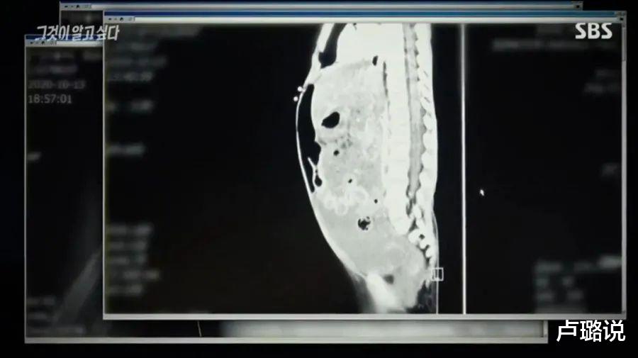 卢璐说|16个月女婴被虐打致死,800多个视频揭露了养父母的人面兽心
