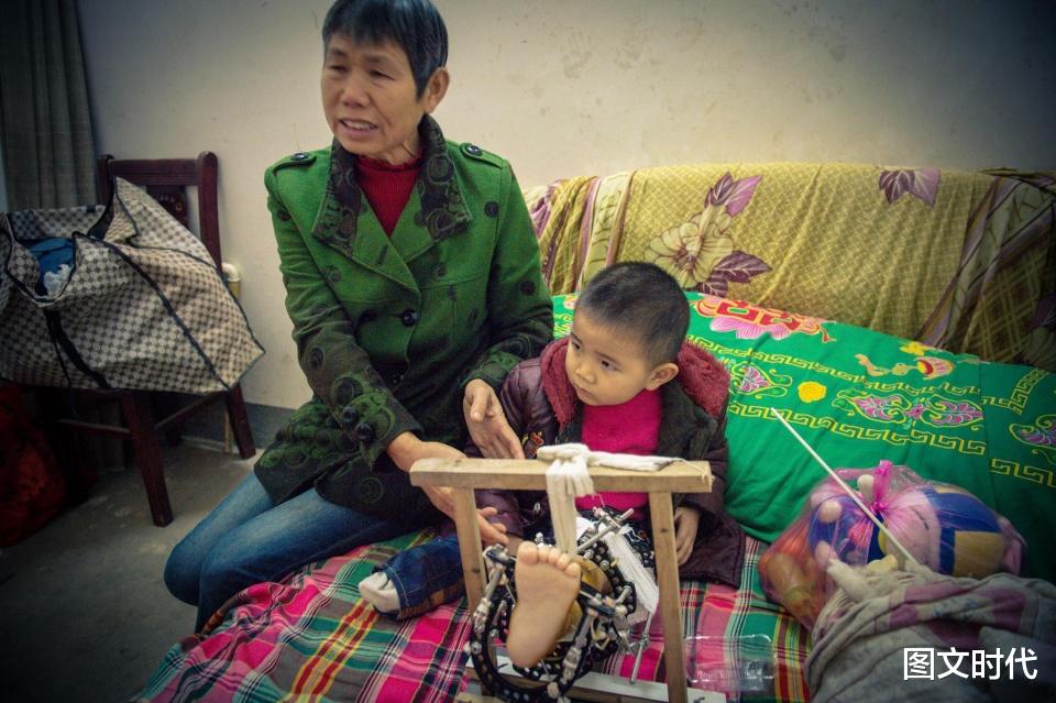 图文时代 幼童遭黑车碾压失去右腿,7旬奶奶学护理,想保住打8枚钢钉的左腿