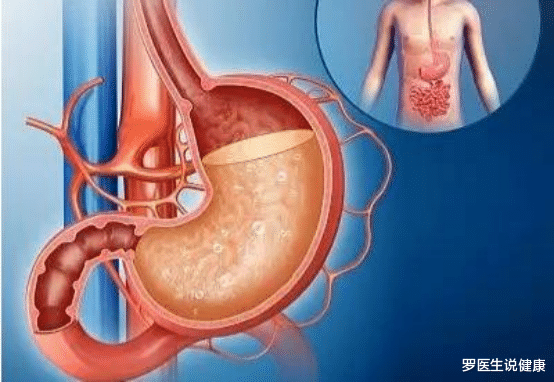 肝硬化|藏在身边的“健脾高手”被发现，不是猪肚，孩子坚持吃，增强免疫力少生病