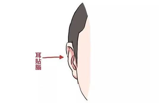 天行健人自强|发大财黄金耳相看看你有吗?