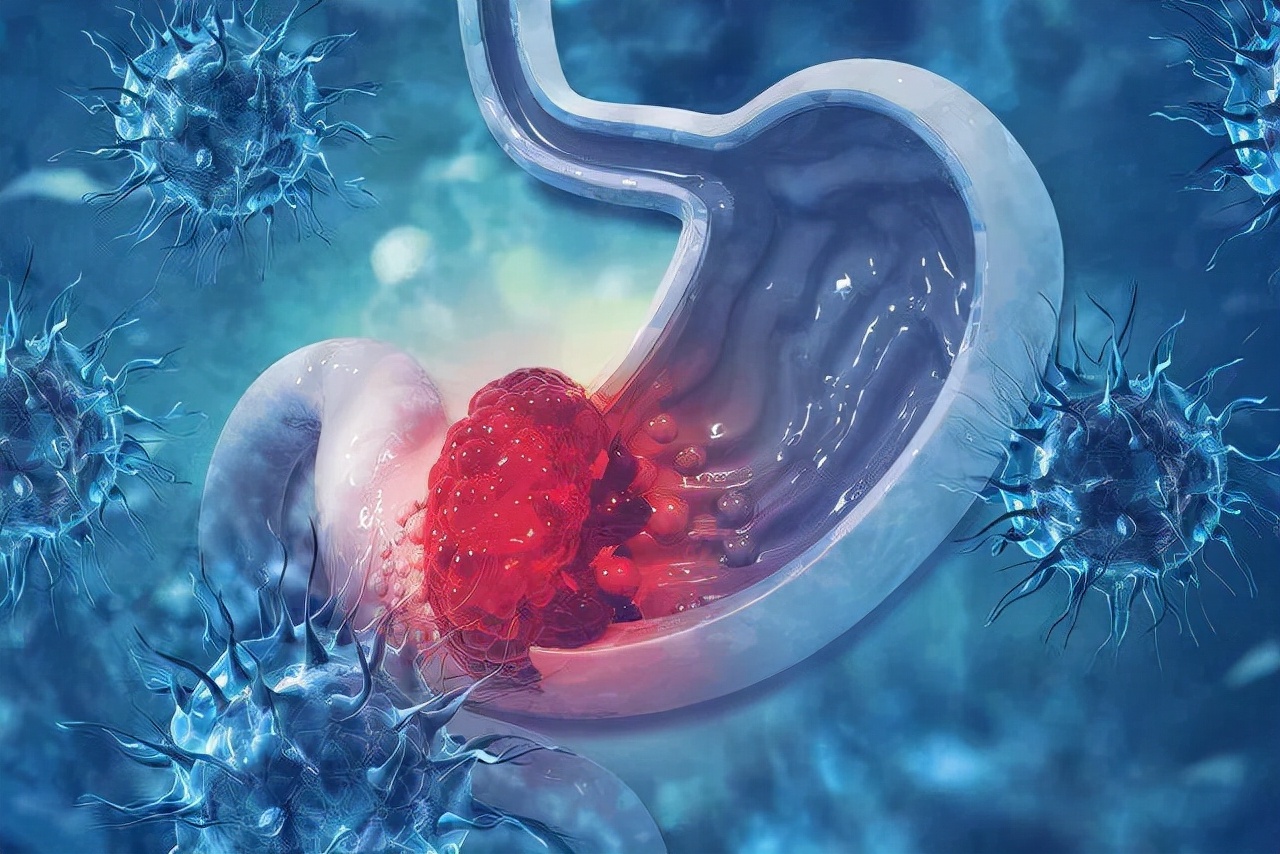 |“养胃宝”已公布,医生:你若坚持吃,胃炎或能“不攻自破”