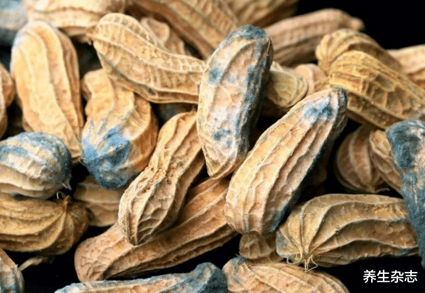 甲状腺癌|甲状腺癌“源头”公布,多名院士忠告:别再冤枉肥肉,这1物很多人天天在吃