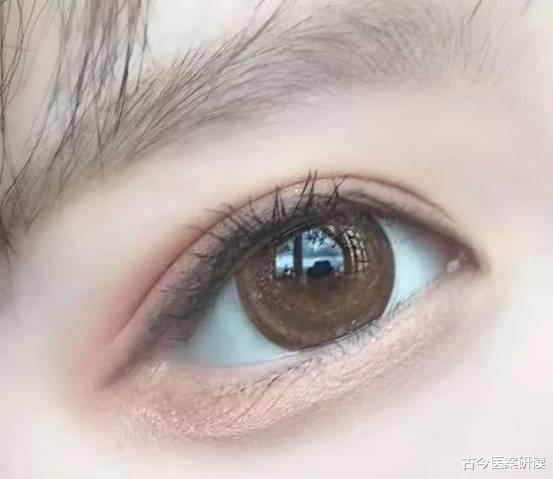 肝脏|院士直言:眼睛是肝脏的“报警器”,一旦有这4种异常,及时做肝CT