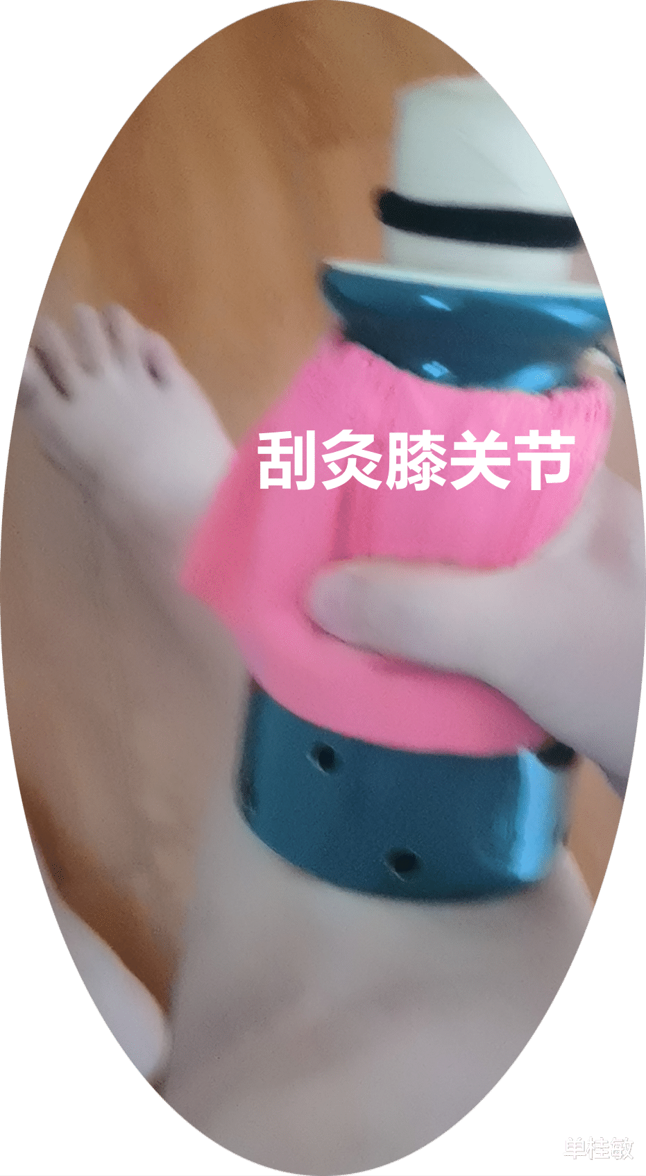 |半月板損傷的多種調理方法