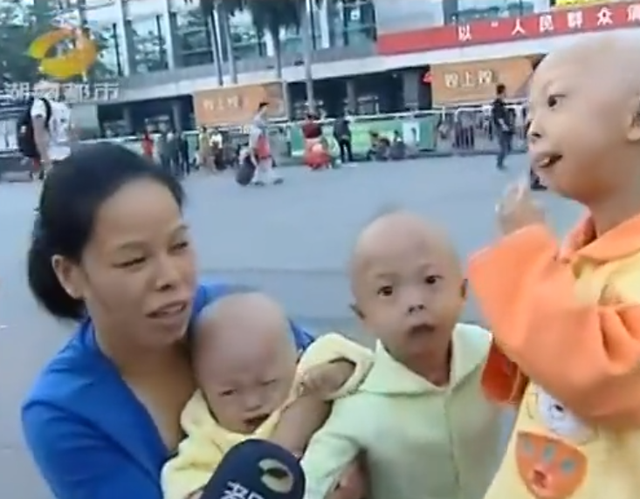 外星人 她们被外界人称“外星人”，健康的父母为何会生出长相怪异的孩子