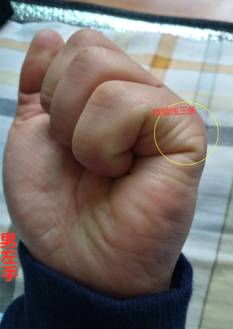 诚然情感之事|手相：手有M纹，中晚运发福