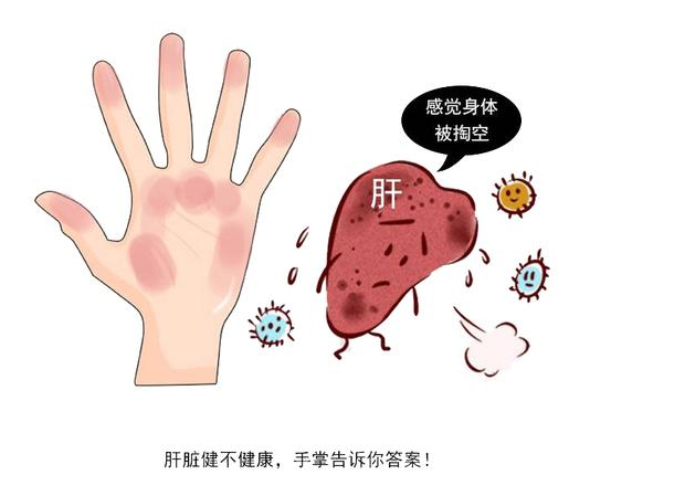 肝硬化|肝硬化的“推进器”已公布，肝不好的人，别忽视这4种异常变化！