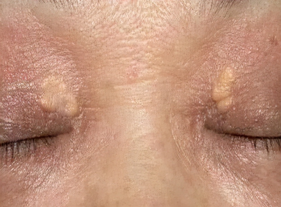 苹果|血液“稀释剂”找到了，白开水排第4，“第1”很多人没注意