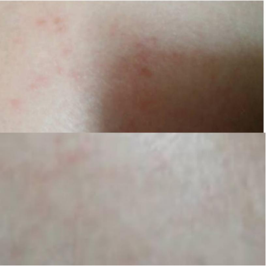 卓卓and然然|“孕妇长纹十有八九”,孕期出现妊娠纹该咋办?可以试试这几招!