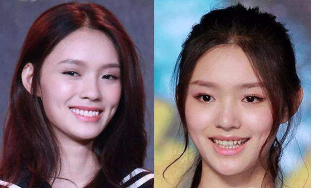 王安宇|女明星“假牙”大PK,谁的嘴巴闭不上,谁的嘴里藏着一套房?