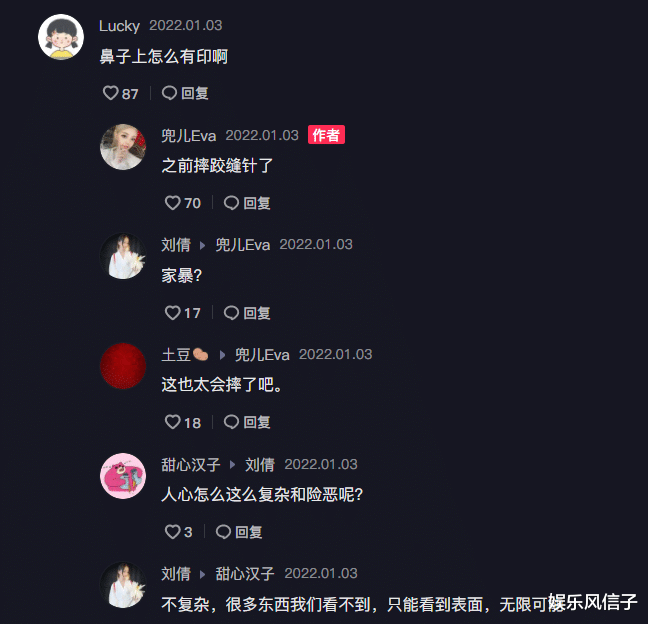 韩安冉|兜儿近照鼻梁上有“黑印”,称摔跤缝过针,网友:家暴?