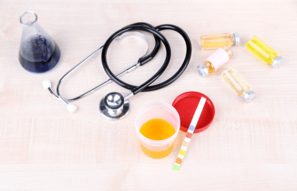 痛风|蛋白尿总反复，如何换药或加药？这3种药最好联合用