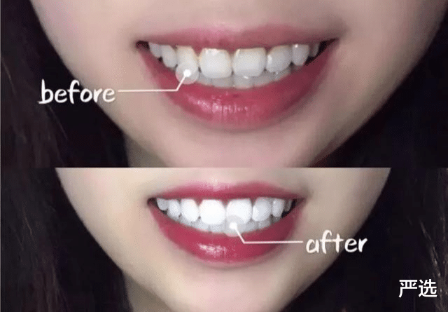 牙齿|牙齿太黄不自信?不用洗牙,教你一个笨办法,用后牙黄牙渍全没了