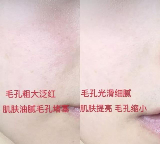 好物官|吴昕皮肤光滑白皙，坚持每天用它洗脸，3次就能“震”毛孔垃圾
