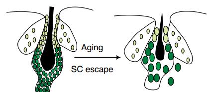 基因 你的毛囊干细胞它跑路了！科学家发现秃头新原因