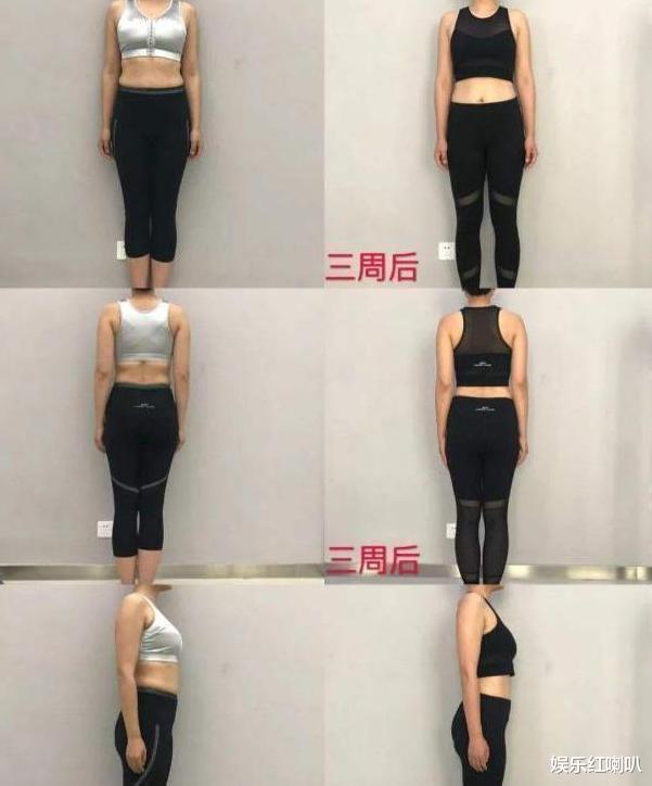 景甜|为爱减肥！男子155kg成功减肥150斤后变帅小伙，运动作用大