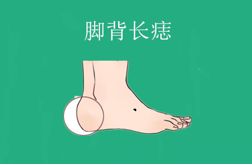 中国易经风水 身上4颗“穷”痣，吃不好，穿的差，老人孩子养不起，奔波一生！