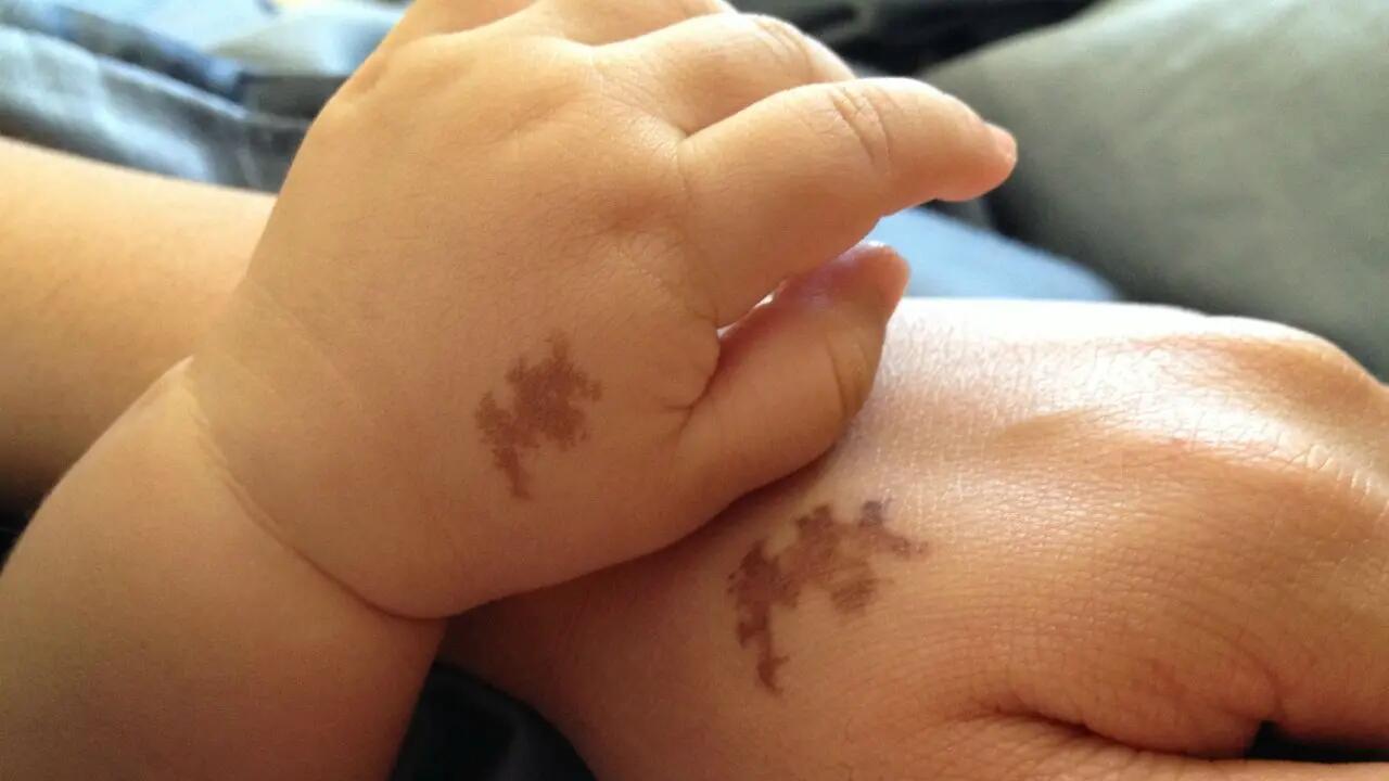 旧海拾荒|身上有胎记是不是病?竟然有些胎记还被认为是幸运的标志?