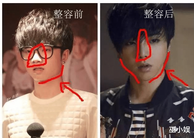 华晨宇|网传华晨宇整容失败？导致颜值下滑，目前已闭关去修复脸了？