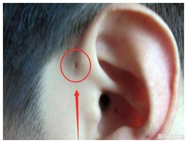 基因 人类最稀有的9种基因，全球拥有者仅5%，看看你有吗