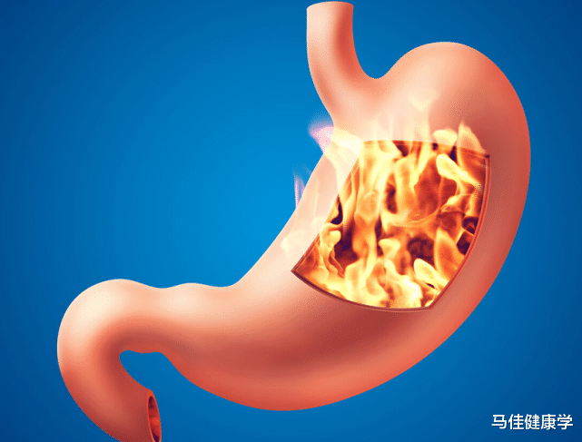 胃癌|32岁男子从不吃辣椒,确诊胃癌,医生:或与喝水1个“习惯”有关