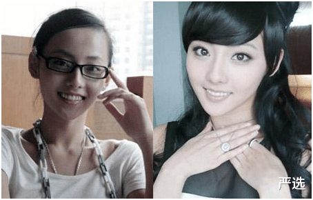 严选|8年前整容成白雪公主的女人,如今竟成这般模样?网友:难以相信