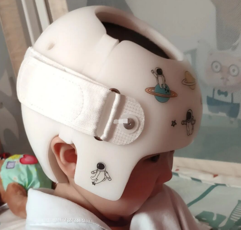 Hi家有小甜椒儿|外貌焦虑波及宝宝，给婴儿带“头型矫正器”矫正头型，咋想的啊