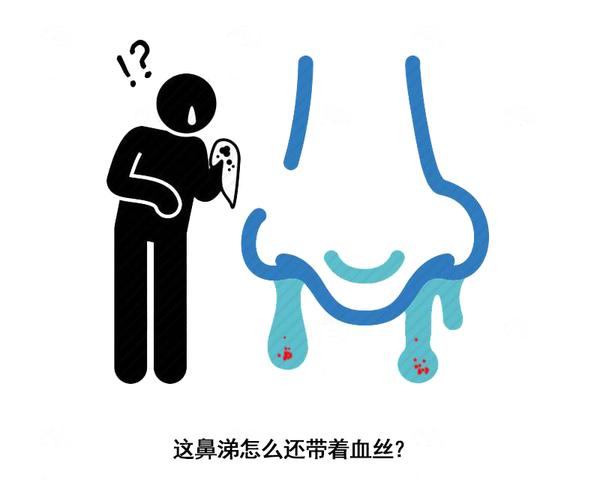 脾胃|脑出血发作前，身体会有这4个“信号”，别忽视了，及时就医