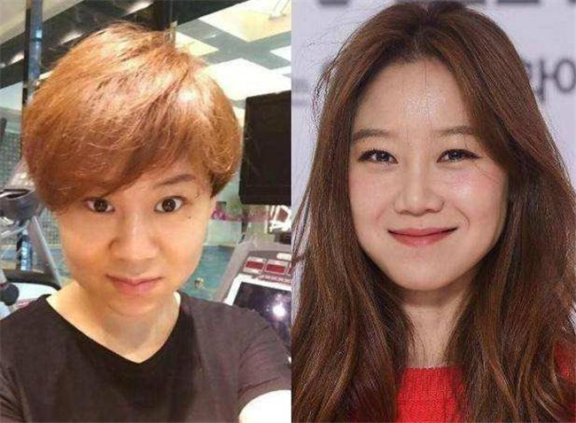 小沈阳|有种“整容”叫小沈阳老婆，狂减20斤颜值逆袭，意外撞脸韩国女神