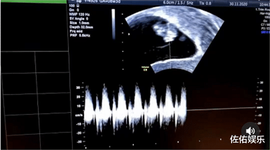 情人节|知名女星情人节官宣怀二胎，大肚如箩还与女儿嬉戏打闹超幸福