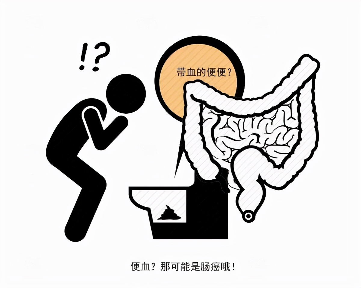 漫说健康|结肠有癌，排便告知？若还出现这5个现象，暗示结肠癌正“盯上”