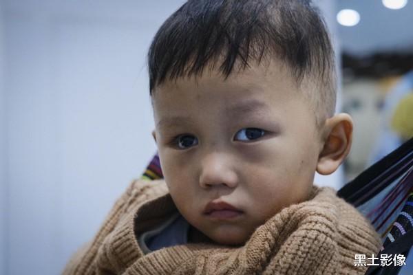 黑土影像 安徽一2岁男童眼睛突然发光疑似猫眼,医生看了后说眼球保不住了