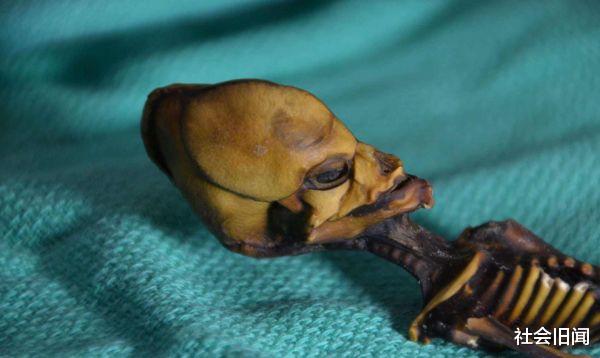 UFO 加拿大UFO伤人事件被曝光，男子触摸外星飞碟被灼伤，身上留下终身烙印