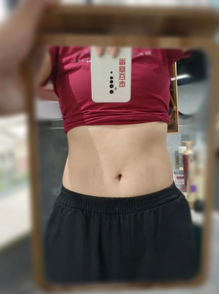 樱桃妈咪|产后能完全祛除妊娠纹？医生：不可能！但可以试试这3个淡化妙招