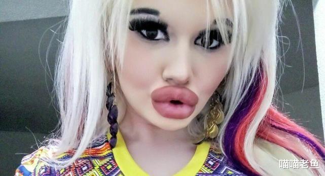 |自称是世界上嘴唇最性感的女人，保加利亚网红17次丰唇闭不上嘴