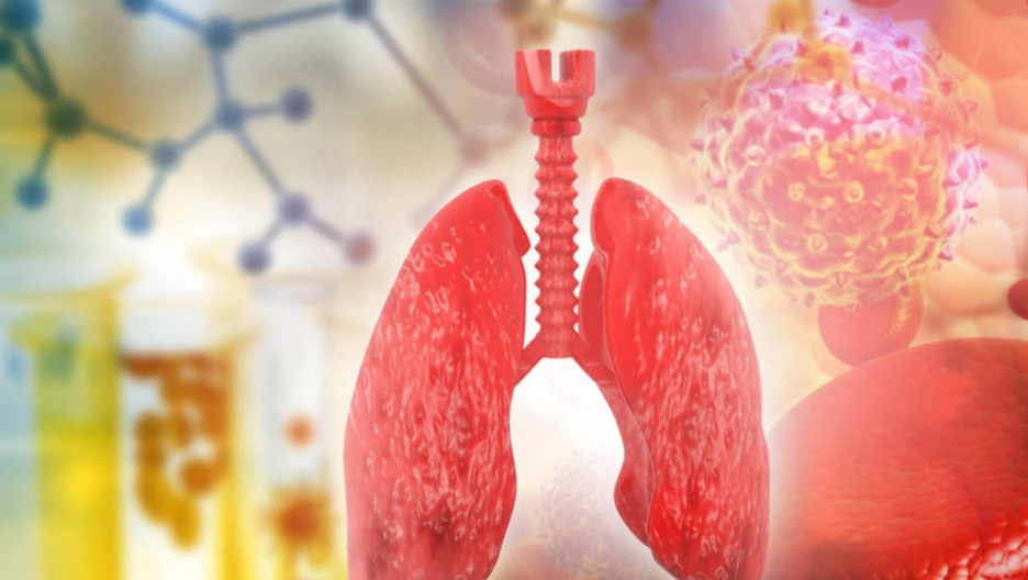 肺病|肺不好,日常坚持“3少吃”,养肺排毒,远离肺病侵扰